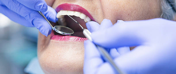 Best Emergency Dental Extractions in Del Norte, CO